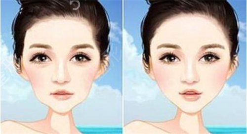 ������������ҽԺ����֬����ֲ����沿����ô��