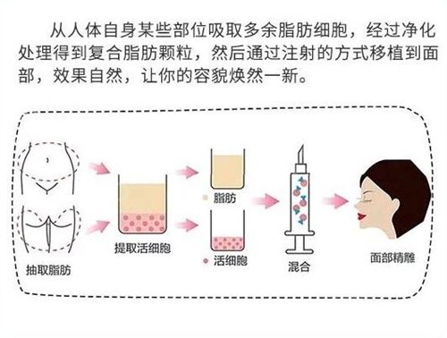 ������������ҽԺ����֬����ֲ����沿����ô��