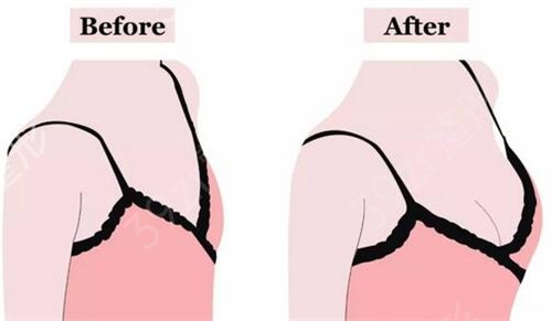 2022����֬�����ҽ������ǰ��Ȩ��ר�ҽ���