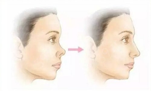 �人�ĸ�ҽԺ�����Ӻ�