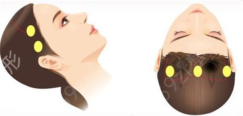 2022杭州整形公立医院排名榜前三