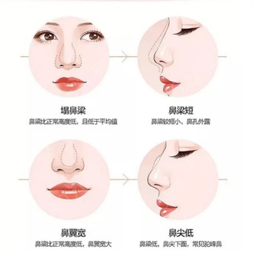 福建三甲整形医院哪个好