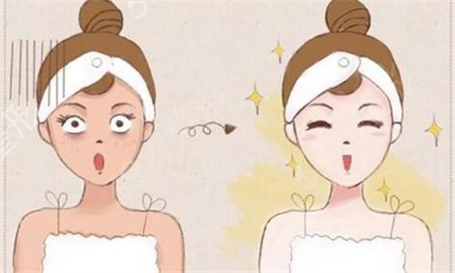 上海面部拉皮好的整形医院排名榜分享