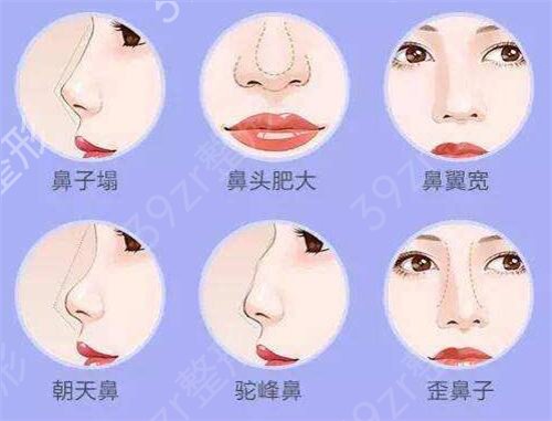 全国整形医院排名查询