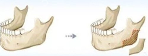 ��ɳ����ĥ���ļ�ҽԺ��