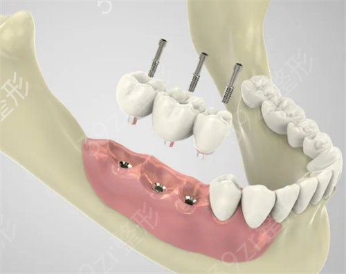 南京公立的口腔医院有哪些