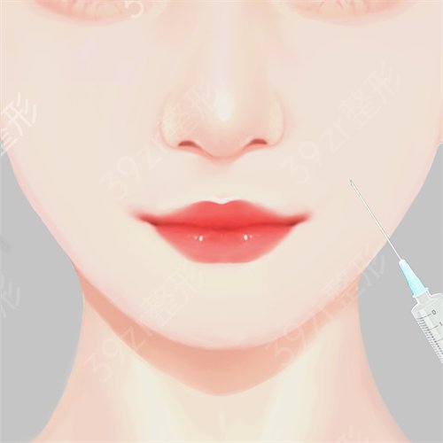 兰州华夏医院做的激光溶脂瘦脸