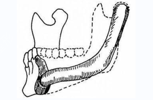上海哪里磨骨好