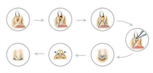 2022�����Ӽ����ĸ�ҽ����