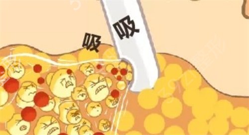 苏州正规的整形医院哪家好