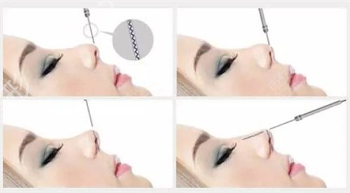 2022上海高端整形美容医院排行前五名单揭晓