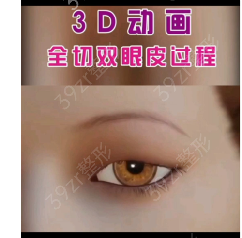 2022北京修复双眼皮厉害的专家有哪些