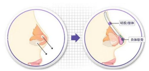 Ҽ��Ҽ����ҽԺ��ô��