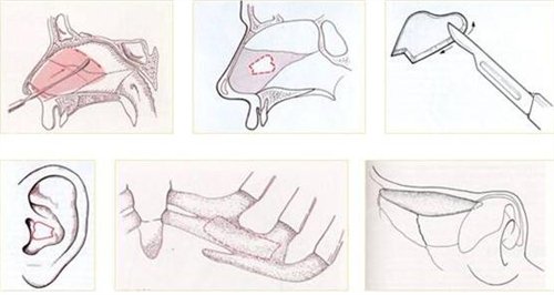 ����ά�����������ռǱ���