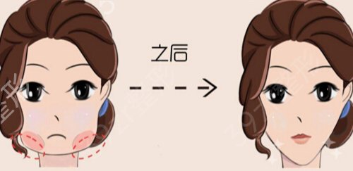 上海面部轮廓医生排名榜前四权威发布