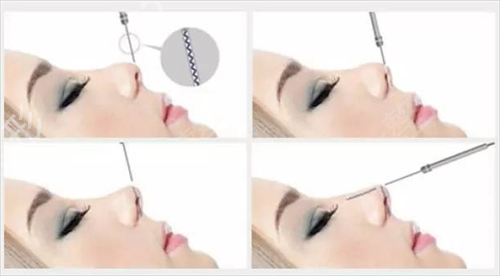 ��������ҽԺ�ļ�ǿ