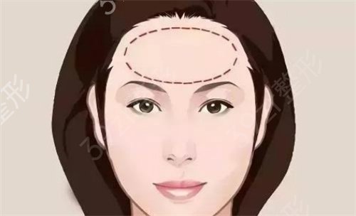 ������������֬�����ҽ���Ƽ�_����ǰ����������