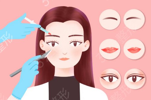上海哪里做双眼皮修复好