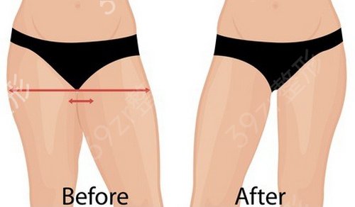 �����ļ�ҽԺ��֬�ȽϺ�