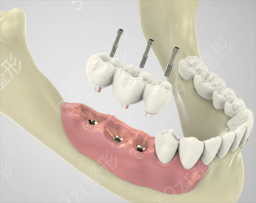 ������ֲ��ҽԺ��������