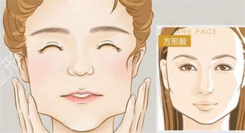 成都磨骨技术好的医生有哪些