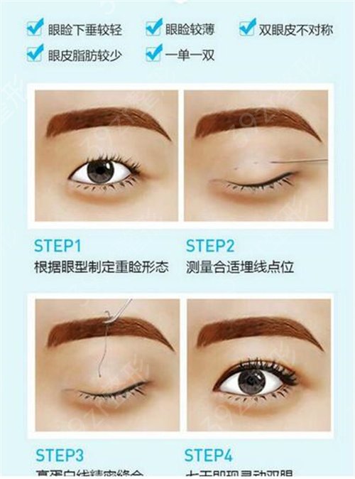 ���ݹ���ҽԺ��˫��Ƥ�ļҺ�