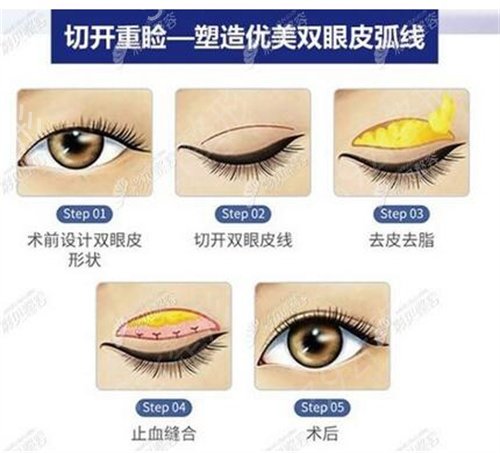 ֣�ݻ�ɽ����ҽԺ˫��Ƥ��ʵ��������