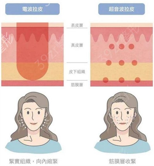 国内面部提升权威专家排名介绍