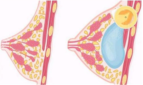 惠州鹏爱医院简介—口碑—内附海量真实案例供大家参考