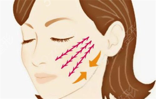 北京哪个整形医院面部拉皮祛皱好