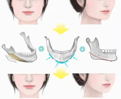 �人��������ҽԺ����������Щ