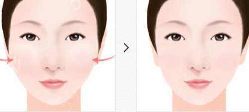 杭州整形外科好的三甲医院有哪些