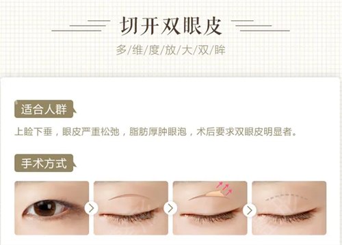 2022֣��˫��ƤҽԺ���а�������Ϯ