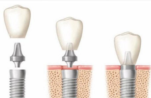 �Ϻ���ֲ��ҽԺ����ǰ��Ȩ������