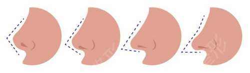 上海做鼻子好的医生是谁