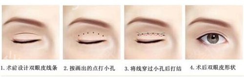 ����������˫��Ƥ�õ�ҽԺ����ǰ������