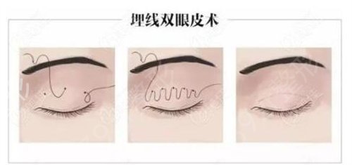 ����������ҽԺ��˫��Ƥ��Щ��