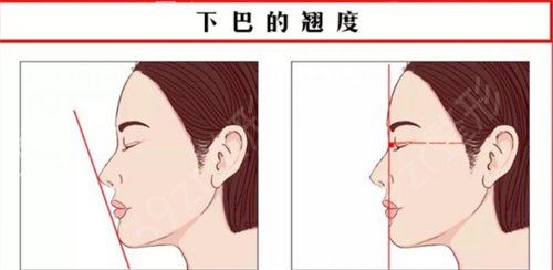 陕西友谊医院整形科卢丙仑下颌角怎么样