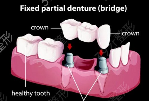 ������ֲ��˽��ҽԺ����ǰ��ǿ����