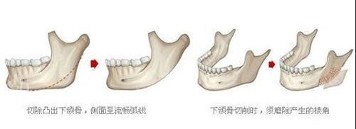 ��ɳ����ҽ������ǰ��Ȩ������