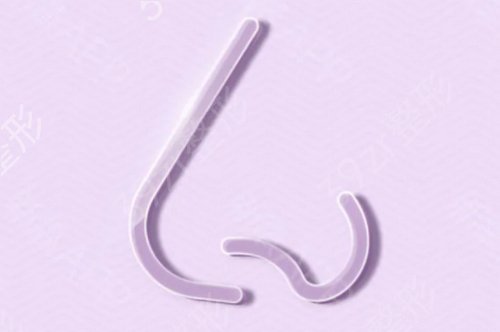 广东广州美恩整形美容医院膨体隆鼻好不好呢