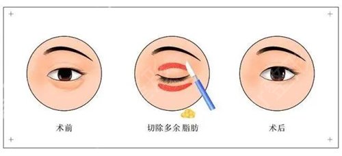 ����ȥ�۴������ļ�ҽԺ�ɿ�