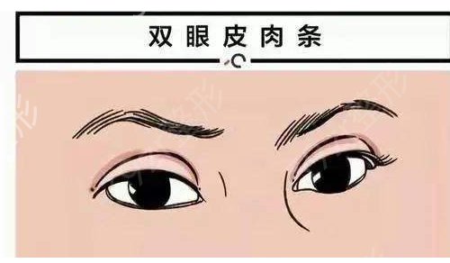 称赞黑龙江瑞丽整形美容医院的双眼皮项目