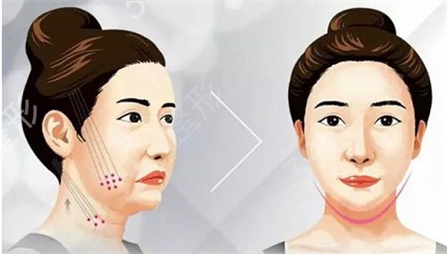 �人��Ƥ���������ļ�Ȩ��