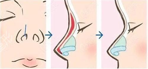 武汉五洲莱美医疗美容整形医院怎么样