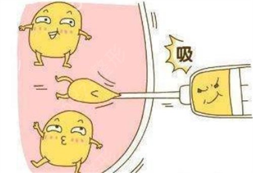 �人ҽԺϣ˼����֬����ô��