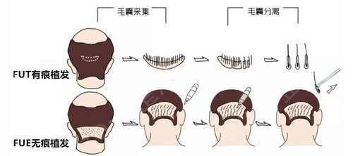 南昌宏昌植发医院怎么样