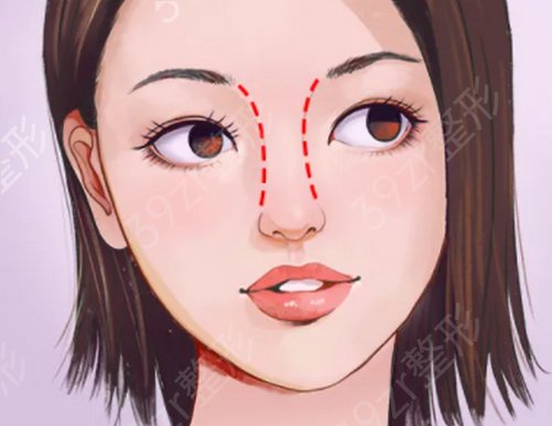 成都三甲整形医院排行哪家好