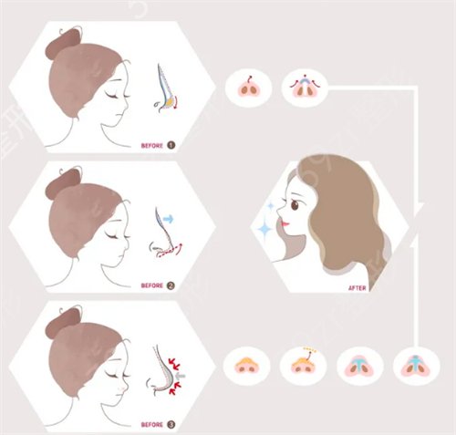 成都三甲整形医院排行哪家好