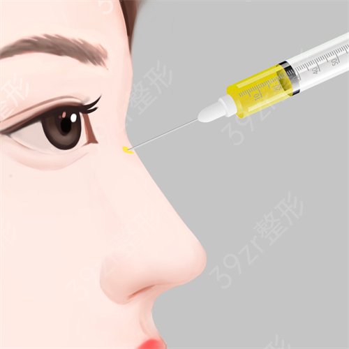 广州隆鼻三甲医院排名榜前三更新